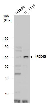 PDE4B Rabbit Polyclonal Antibody