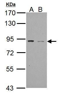 PDE4B Rabbit Polyclonal Antibody