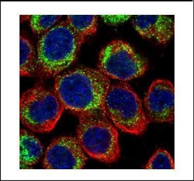 PDE4D Rabbit Polyclonal Antibody