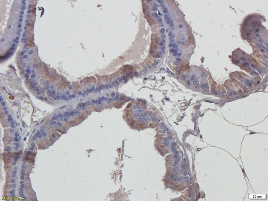 PDE5A Rabbit Polyclonal Antibody