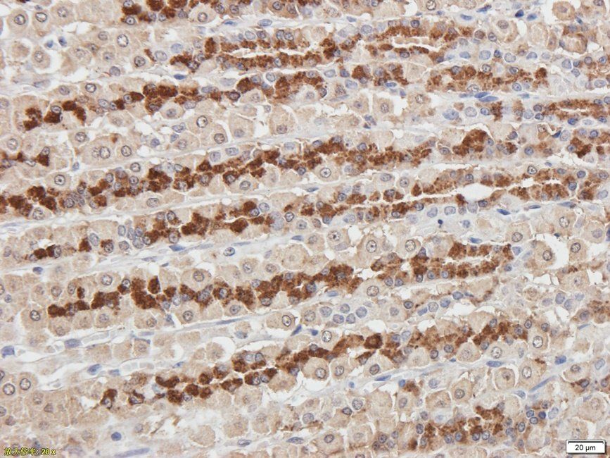 PDE5A Rabbit Polyclonal Antibody