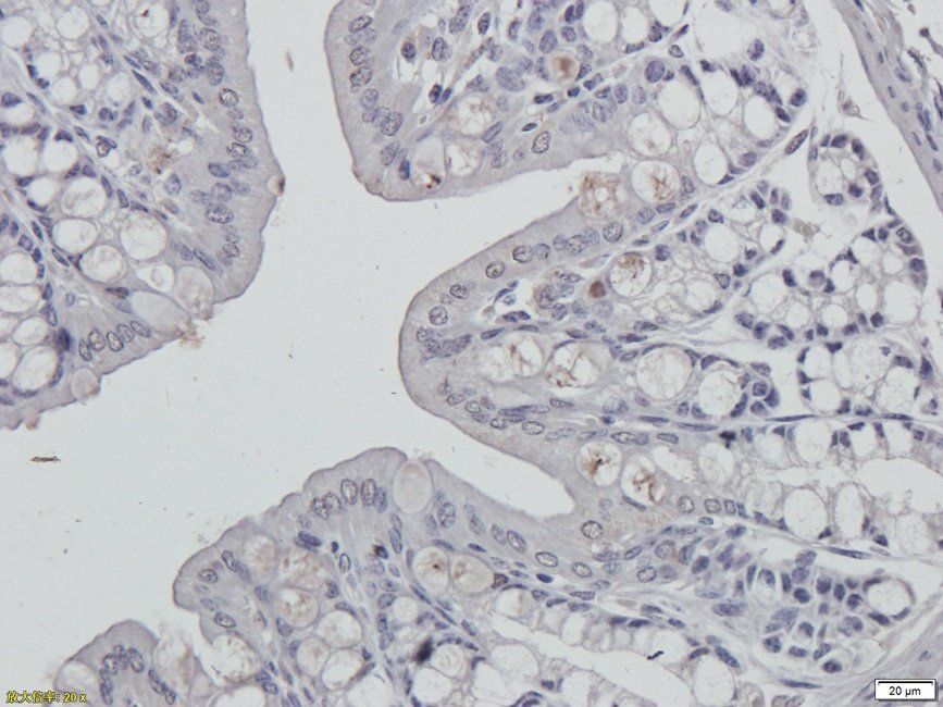 PDE5A Rabbit Polyclonal Antibody