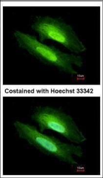 PDE6D Rabbit Polyclonal Antibody