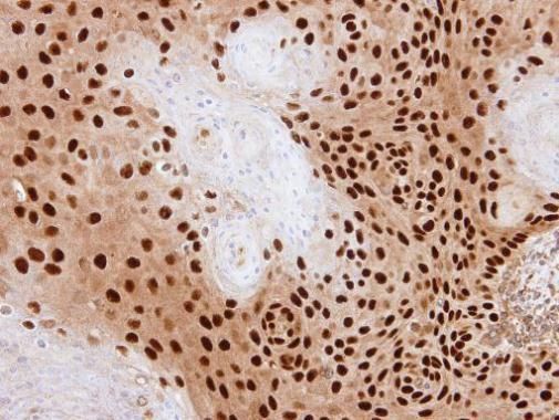 PDE6D Rabbit Polyclonal Antibody