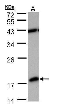 PDE6D Rabbit Polyclonal Antibody