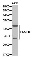 PDGFB Antibody