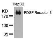 PDGFRB Antibody