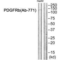 PDGFRB Antibody