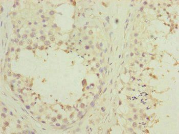 PDHA2 Antibody