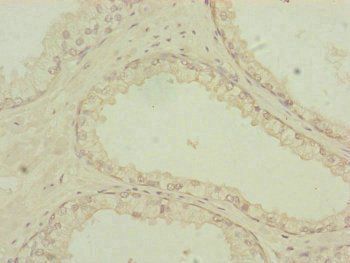 PDHA2 Antibody