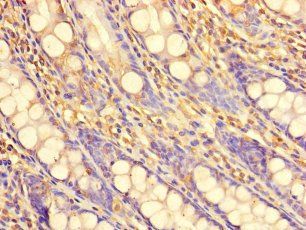 PDIK1L Antibody