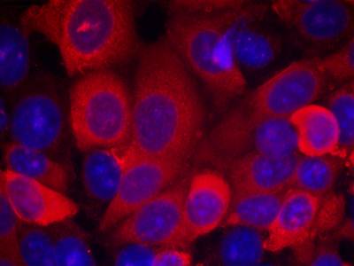 PDK1 Rabbit Polyclonal Antibody
