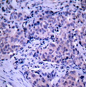 PDK1 Rabbit Polyclonal Antibody
