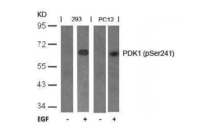 PDK1 (Phospho-Ser241) Antibody