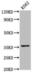 PDLIM4 Antibody