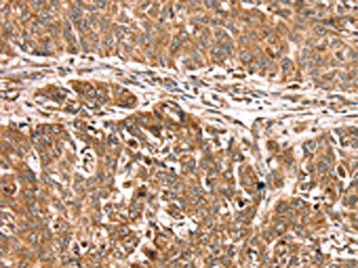 PDLIM4 Antibody