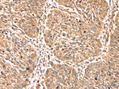 PDLIM4 Antibody