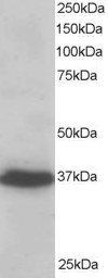 PDLIM4/RIL Antibody