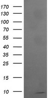 PDLIM5 Antibody