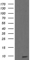 PDLIM5 Antibody