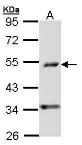 PDSS2 Rabbit Polyclonal Antibody