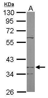 PDSS2 Rabbit Polyclonal Antibody