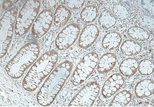 PDXDC1 Rabbit Polyclonal Antibody