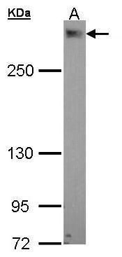 EPM2AIP1 Rabbit Polyclonal Antibody