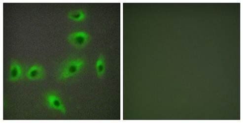 BAX Antibody