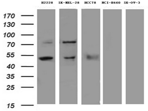 ETV4 Antibody