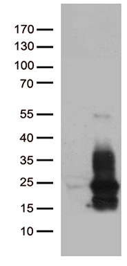 ETV4 Antibody