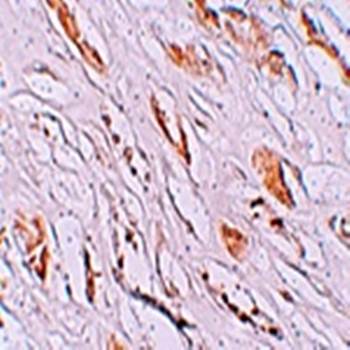 PEAR1 Rabbit Polyclonal Antibody