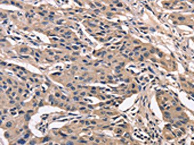 PEBP1 Antibody