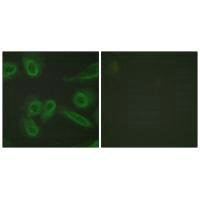 PECAM1 Antibody