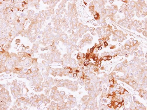 Alpha 2 Antiplasmin antibody [N3C3]