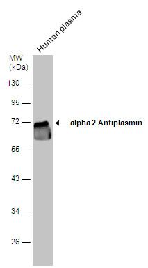 Alpha 2 Antiplasmin antibody [N3C3]