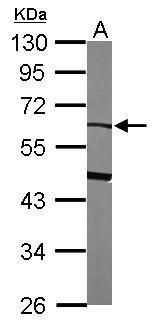Alpha 2 Antiplasmin antibody [N3C3]