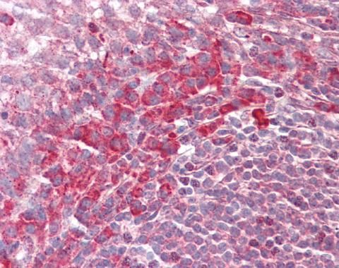PEX13 Rabbit Polyclonal Antibody