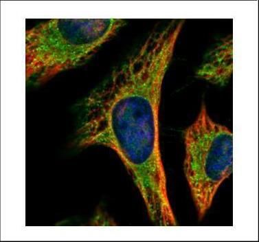 PEX19 Rabbit Polyclonal Antibody