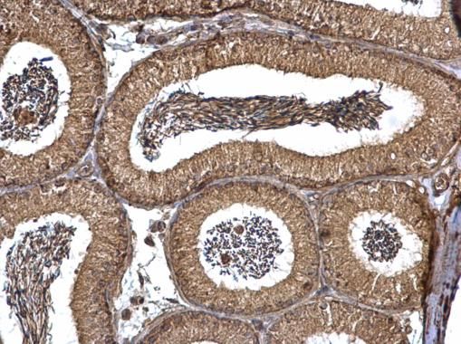 PEX19 Rabbit Polyclonal Antibody