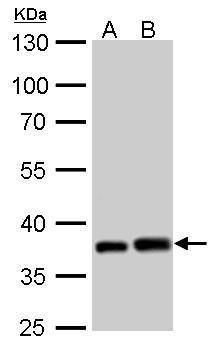PEX19 Rabbit Polyclonal Antibody
