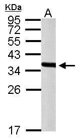 PEX19 Rabbit Polyclonal Antibody