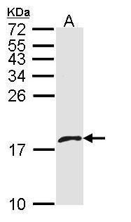 platelet factor 4 variant 1 Antibody
