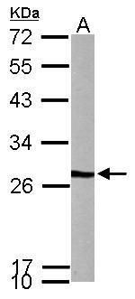 PFDN3 antibody