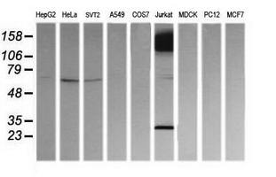 PFDN3 Antibody