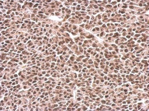 PFKFB3 Rabbit Polyclonal Antibody