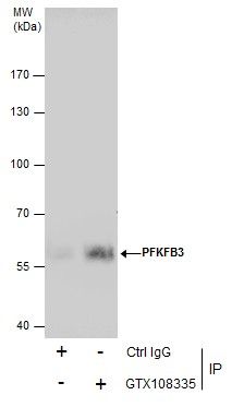 PFKFB3 Rabbit Polyclonal Antibody