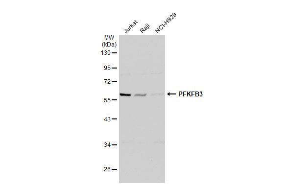 PFKFB3 Rabbit Polyclonal Antibody