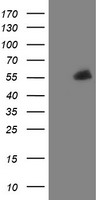 PFKP Antibody