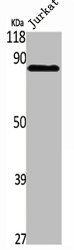 PFKP Antibody